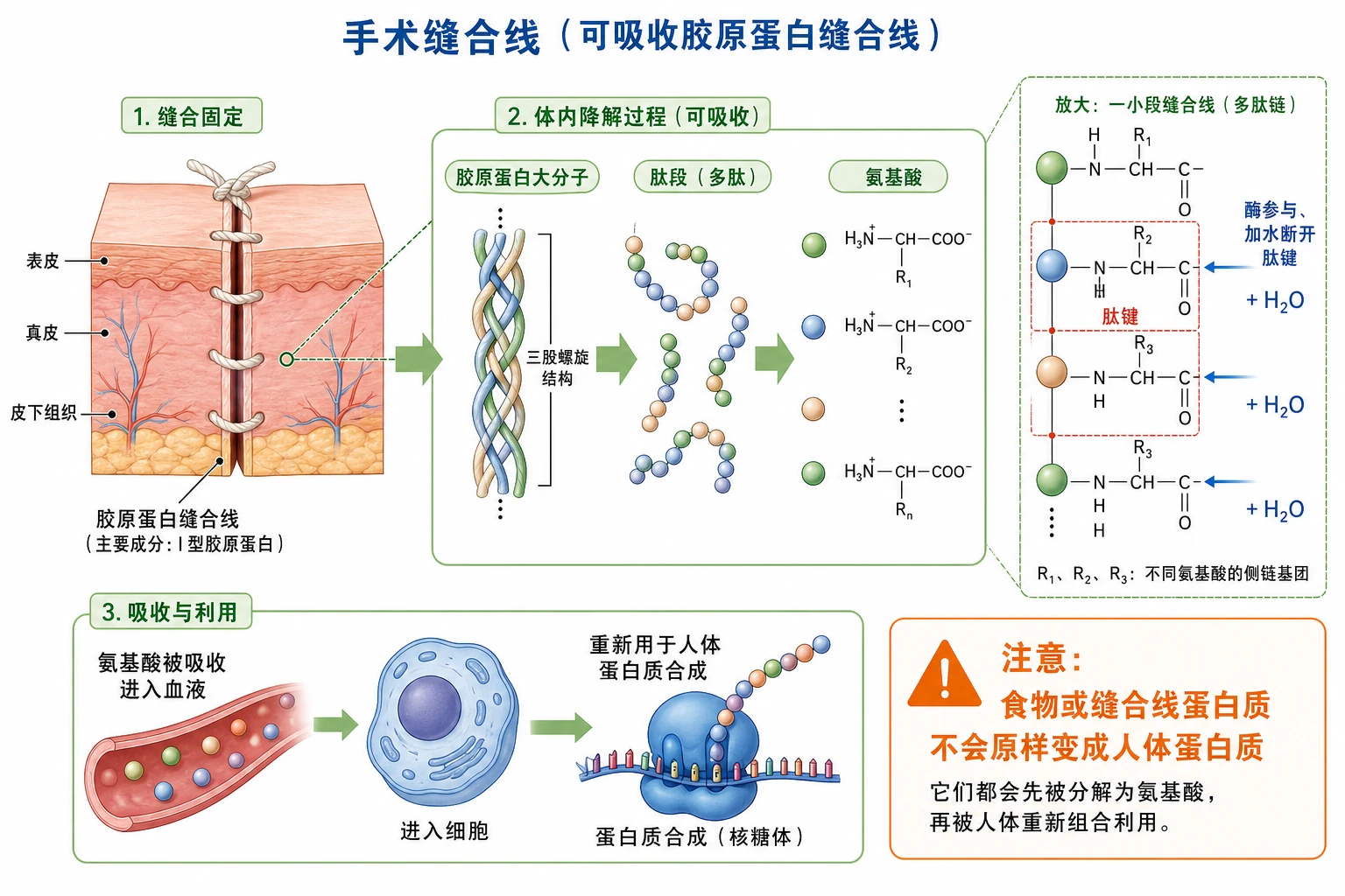 图02:教材“手术缝合线”源图重绘